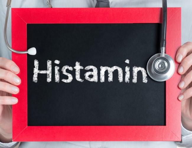 Histamin İntoleransı